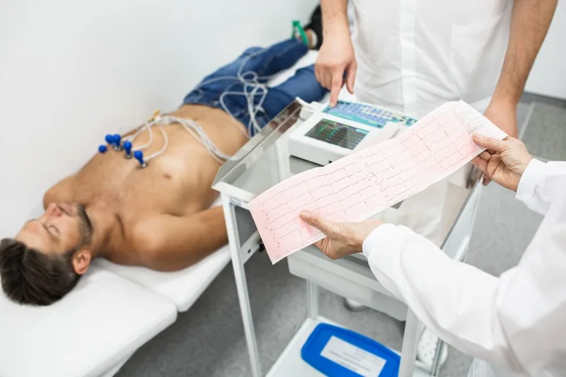 Electrocardiograma (ECG)